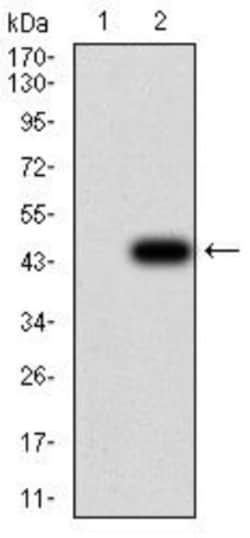 GFPT1 Antibody (1F1A4) - BSA Free, Novus Biologicals 0.1mg; Unlabeled:Antibodies,